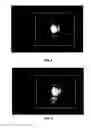 Fig. 08 - Feature Detection And Measurement In Retinal Images