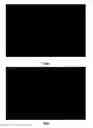 Fig. 12 - Feature Detection And Measurement In Retinal Images