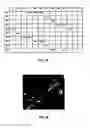 Fig. 18 - Feature Detection And Measurement In Retinal Images