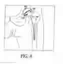 Fig. 07 - Method and system for surgical modeling