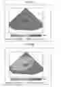 Fig. 06 - Medical image diagnosis apparatus and image processing apparatus and method