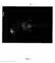 Fig. 06 - Detection of landmarks and key-frames in cardiac perfusion MRI using a joint spatial-temporal context model