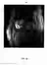 Fig. 07 - Detection of landmarks and key-frames in cardiac perfusion MRI using a joint spatial-temporal context model