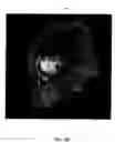 Fig. 08 - Detection of landmarks and key-frames in cardiac perfusion MRI using a joint spatial-temporal context model