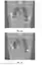 Fig. 05 - 4D anatomically based image selection procedure for medical imaging