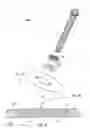 Fig. 11 - Variable angled locking screw