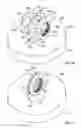 Fig. 15 - Variable angled locking screw