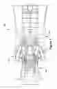 Fig. 02 - Methods, systems and apparatus for detecting material defects in rotor blades of combustion turbine engines