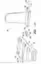 Fig. 03 - AXIAL RETENTION DEVICE FOR TURBINE SYSTEM