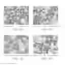 Fig. 07 - Methods of Treating Pediatric Acute Lymphoblastic Leukemia with an Anti-CD22 Immunotoxin