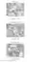 Fig. 09 - Methods of Treating Pediatric Acute Lymphoblastic Leukemia with an Anti-CD22 Immunotoxin