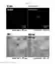 Fig. 11 - MICROVESICLES DERIVED FROM NUCLEATED, MAMMALIAN CELLS AND USE THEREOF