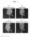 Fig. 02 - Polyion complex comprising PHD2 expression inhibiting substance