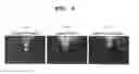 Fig. 06 - Polyion complex comprising PHD2 expression inhibiting substance