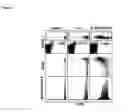 Fig. 02 - Method for treating cancer by administering IL-15 and IL-15Ralpha complexes