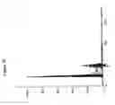Fig. 16 - Compositions and methods for treatment, diagnosis and prognosis of mesothelioma