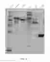 Fig. 06 - Manufacturing and Purification Processes of Complex Protein found in Fraction IV   to make a separated  Apo, Transferrin  , and Alpha 1 Anti strepsin (A1AT) or  A combined Transferrin / Apo/Human Albumin/A1AT and all new found proteins
