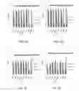 Fig. 44 - Manufacturing and Purification Processes of Complex Protein found in Fraction IV   to make a separated  Apo, Transferrin  , and Alpha 1 Anti strepsin (A1AT) or  A combined Transferrin / Apo/Human Albumin/A1AT and all new found proteins