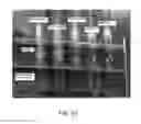 Fig. 46 - Manufacturing and Purification Processes of Complex Protein found in Fraction IV   to make a separated  Apo, Transferrin  , and Alpha 1 Anti strepsin (A1AT) or  A combined Transferrin / Apo/Human Albumin/A1AT and all new found proteins