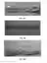 Fig. 49 - Manufacturing and Purification Processes of Complex Protein found in Fraction IV   to make a separated  Apo, Transferrin  , and Alpha 1 Anti strepsin (A1AT) or  A combined Transferrin / Apo/Human Albumin/A1AT and all new found proteins