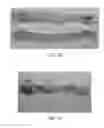 Fig. 53 - Manufacturing and Purification Processes of Complex Protein found in Fraction IV   to make a separated  Apo, Transferrin  , and Alpha 1 Anti strepsin (A1AT) or  A combined Transferrin / Apo/Human Albumin/A1AT and all new found proteins