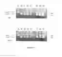 Fig. 06 - Use of gingival fibroblasts for vascular cell therapy