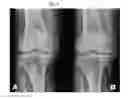 Fig. 07 - COMPOSITION COMPRISING A HAEMATIC COMPONENT AND ITS USE FOR THE TREATMENT OF DEGENERATIVE JOINT DISEASE