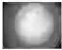 Fig. 01 - Predigested Nutritional Formula