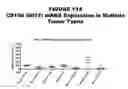 Fig. 115 - Methods and compositions for treating and diagnosing diseases