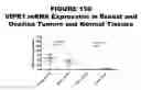 Fig. 151 - Methods and compositions for treating and diagnosing diseases