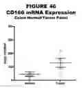 Fig. 47 - Methods and compositions for treating and diagnosing diseases