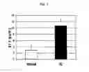 Fig. 02 - Method of diagnosing and treating interstitial cystitis