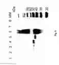 Fig. 15 - IMMUNOMODULATING COMPOSITIONS COMPRISING INTERLEUKIN 13 INHIBITORS AND USES THEREFOR