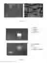 Fig. 06 - Compositions and methods for treatment of cervical dysplasia