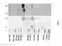 Fig. 03 - Polypeptides and methods for the specific detection of antibodies in patients with a borrelia infection