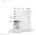 Fig. 04 - Gene expressing a bifidobacterium surface-presented fusion protein