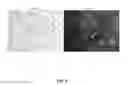 Fig. 06 - Generation of novel bone forming cells (monoosteophils) from LL-37 treated monocytes