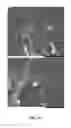 Fig. 12 - Generation of novel bone forming cells (monoosteophils) from LL-37 treated monocytes