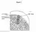 Fig. 02 - Solid forms for tissue repair