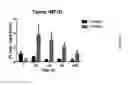 Fig. 05 - MEDICAL USE OF SPLA2 HYDROLYSABLE LIPOSOMES