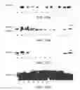 Fig. 11 - NUTRITIONAL COMPOSITIONS INCLUDING BETA-HYDROXY-BETA-METHYLBUTYRATE