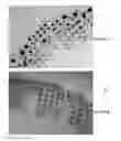 Fig. 01 - PAD PRINTING METHOD FOR MAKING COLORED CONTACT LENSES
