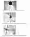 Fig. 15 - High melt temperature microporous lithium-ion rechargeable battery separators and methods of preparation and use