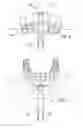 Fig. 04 - Dental prosthesis removal tool
