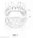 Fig. 02 - Dental device and method of use thereof