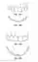 Fig. 06 - Dental device and method of use thereof