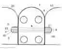Fig. 01 - Dental prosthesis