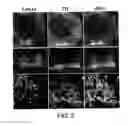 Fig. 04 - Specific marker Lmx1a on dopaminergic neurons