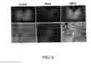 Fig. 06 - Specific marker Lmx1a on dopaminergic neurons