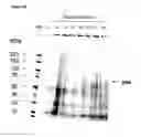 Fig. 05 - Method of preparing plant-derived VLPs